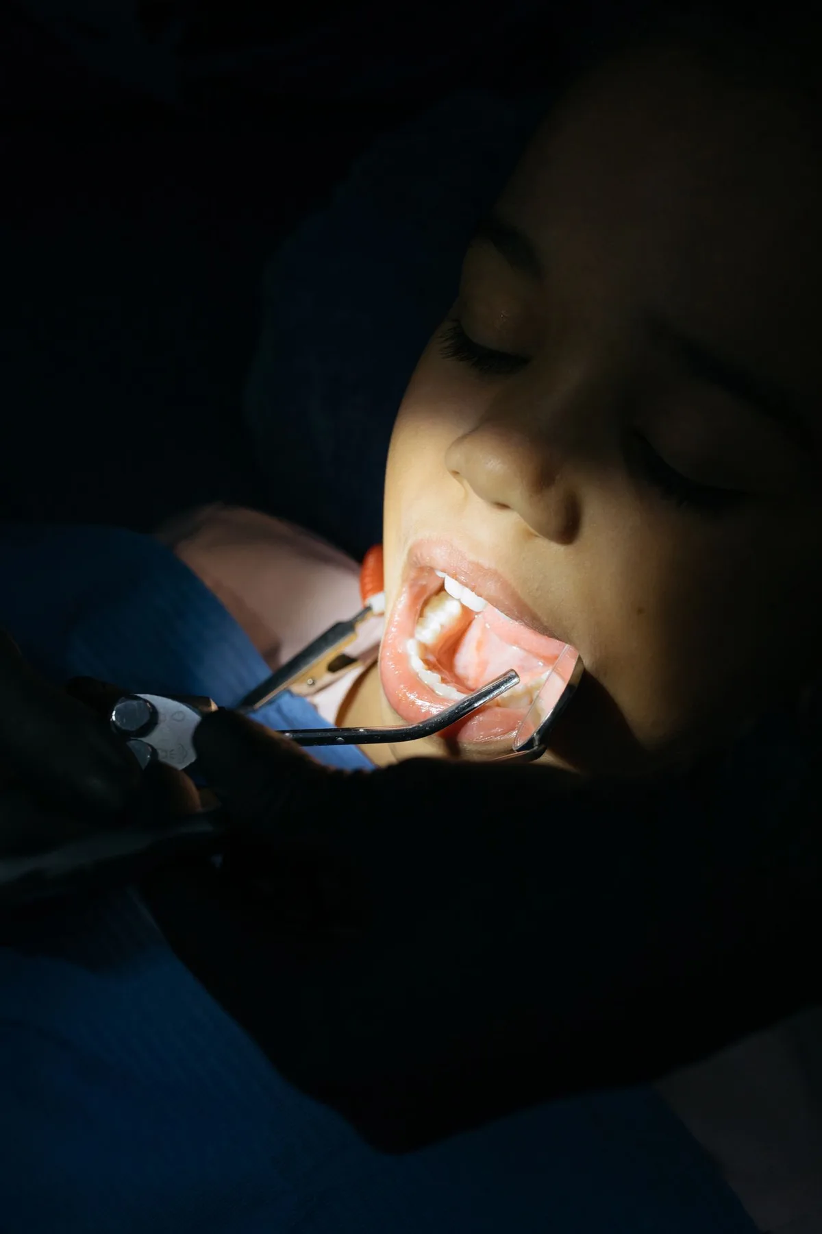 A child receiving a dental examination